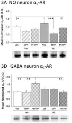 Western Blot: alpha-1A Adrenergic R/ADRA1A Antibody [NB100-78585]